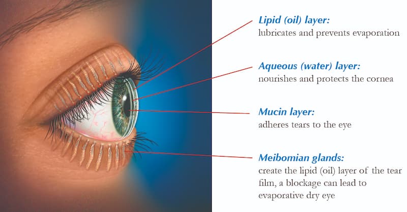 Dry eye anatomy graphic